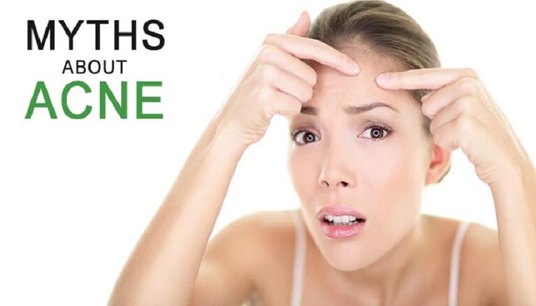 Myths About Acne's Best