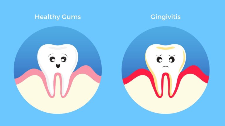 Gum Disease Affects