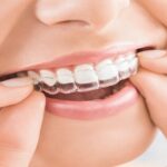 Boulder cosmetic dentist